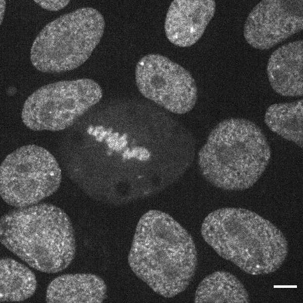 [object Object] thumbnail