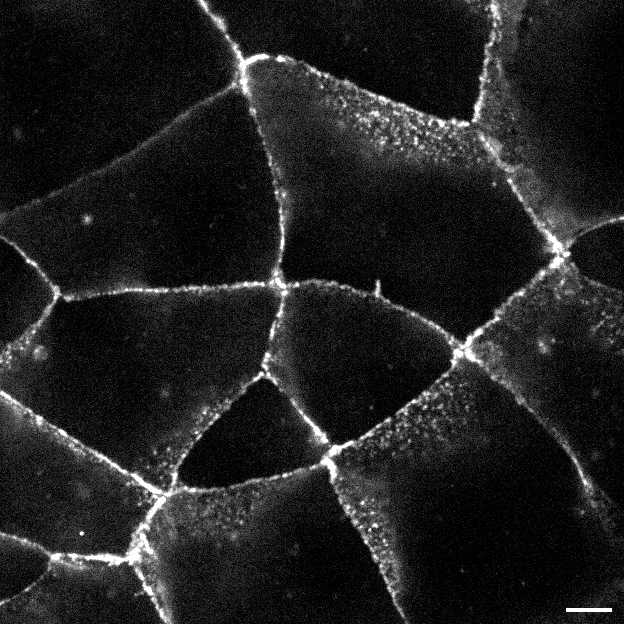 [object Object] thumbnail