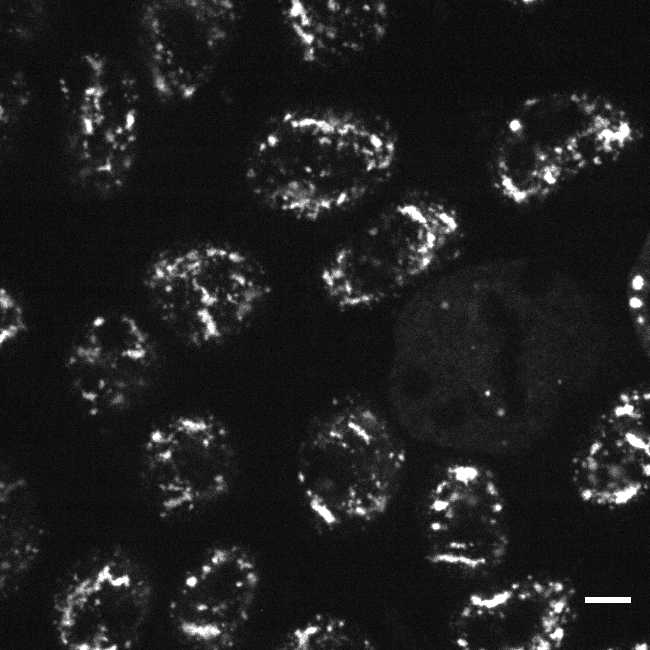 [object Object] thumbnail