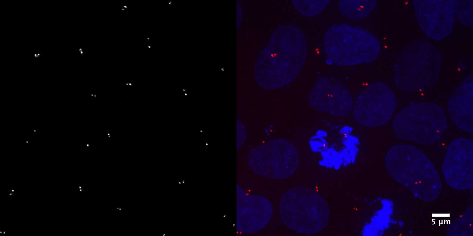 [object Object] thumbnail