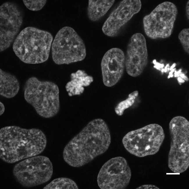 [object Object] thumbnail